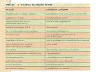 Trauma Torax Dr Membreño