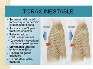 TORAX INESTABLE
 Segmento del pared
torácica que ha perdido
la continuidad ósea
 Asociado a múltiples
fracturas costales
 Relacionado a
contusión pulmonar
 Gravedad = severidad
de lesión parénquima
 Movimiento toráxico
lento y asimétrico
 Hipoxia en gases
arteriales
 Rx que demuestre
fracturas
 