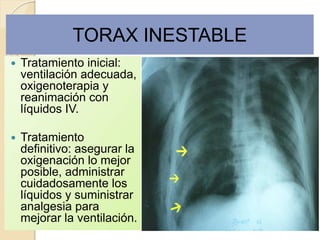 TORAX INESTABLE
 Tratamiento inicial:
ventilación adecuada,
oxigenoterapia y
reanimación con
líquidos IV.
 Tratamiento
definitivo: asegurar la
oxigenación lo mejor
posible, administrar
cuidadosamente los
líquidos y suministrar
analgesia para
mejorar la ventilación.
 