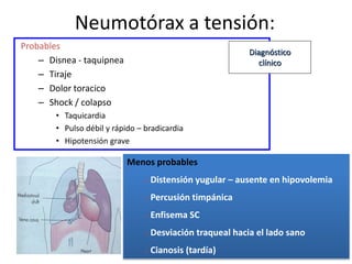 Probables
– Disnea - taquipnea
– Tiraje
– Dolor toracico
– Shock / colapso
• Taquicardia
• Pulso débil y rápido – bradicardia
• Hipotensión grave
Menos probables
 Distensión yugular – ausente en hipovolemia
 Percusión timpánica
 Enfisema SC
 Desviación traqueal hacia el lado sano
 Cianosis (tardía)
Diagnóstico
clínico
Neumotórax a tensión:
 