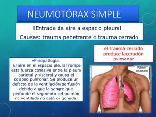 NEUMOTÓRAX SIMPLE
🞇Entrada de aire a espacio pleural
Causas: trauma penetrante o trauma cerrado
el trauma cerrado
produce laceración
pulmonar
•Fisiopatlogia:
El aire en el espacio pleural rompe
esta fuerza cohesiva entre la pleura
parietal y visceral y causa el
colapso pulmonar. Se produce un
defecto de la ventilación/perfusión
debido a que la sangre que
perfunde el segmento del pulmón
no ventilado no está oxigenada.
 
