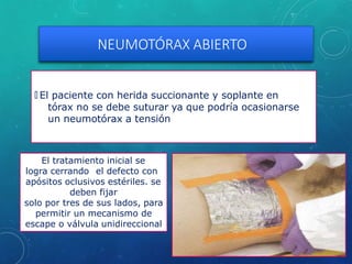 NEUMOTÓRAX ABIERTO
🞇 El paciente con herida succionante y soplante en
tórax no se debe suturar ya que podría ocasionarse
un neumotórax a tensión
El tratamiento inicial se
logra cerrando el defecto con
apósitos oclusivos estériles. se
deben fijar
solo por tres de sus lados, para
permitir un mecanismo de
escape o válvula unidireccional
 