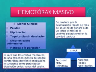 HEMOTÓRAX MASIVO
🞇 Signos Clínicos
🞇 Palidez
🞇 Hipotencion
🞇 Taquicardia sin desviación
🞇 Dolor en bases
pulmonares
🞇 Matidez a la percusión
Se produce por la
acumulación rápida de más
de 1500 ml de sangre o de
un tercio o más de la
volemia del paciente en la
cavidad torácica
Es raro que los efectos mecánicos
de una colección masiva de sangre
intratorácica desvíen el mediastino
lo suficiente como para causar
distensión de las venas del cuello.
shock
Ausencia
Ruidos
respiratorios
Percusión
Mate
Hemitorax
 