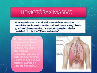 HEMOTÓRAX MASIVO
🞇 El tratamiento inicial del hemotórax masivo
consiste en la restitución del volumen sanguíneo
y, simultáneamente, la descompresión de la
cavidad torácica “Toracostomia”
El tubo se inserta
atreves de la línea
axilar anterior o
axilar media entre el
4to espacio
intercostal cuando se
trata de neumotórax
y entre el 5to y el 6to
espacio cuando se
trata de hemotórax
 
