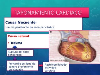 TAPONAMIENTO CARDIACO
Causa frecuente:
trauma penetrante en zona pericárdica
Curso natural
• trauma
Ruptura del saco
pericárdico
Pericardio se llena de
Pericardio se llena de
sangre proveniente
del corazón
Restringe llenado
Restringe llenado
actividad
cardiaca
 