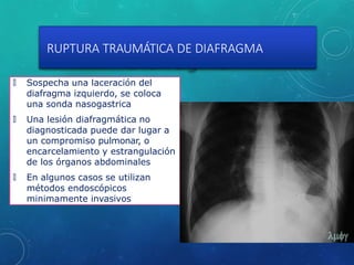 RUPTURA TRAUMÁTICA DE DIAFRAGMA
🞇 Sospecha una laceración del
diafragma izquierdo, se coloca
una sonda nasogastrica
🞇 Una lesión diafragmática no
diagnosticada puede dar lugar a
un compromiso pulmonar, o
encarcelamiento y estrangulación
de los órganos abdominales
🞇 En algunos casos se utilizan
métodos endoscópicos
minimamente invasivos
 
