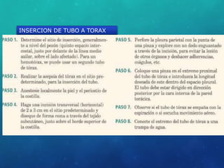 INSERCION DE TUBO A TORAX
 