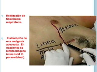 1) Realización de
fisioterapia
respiratoria.
2) Instauración de
una analgesia
adecuada. En
ocasiones se
realiza bloqueo
intercostal O
paravertebral).
 