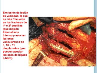Exclusión de lesión
de vecindad, la cual
es más frecuente
en los fracturas de
1ª o 2ª costillas
(que indican
traumatismo
intenso y asocian
lesiones
vasculares) o de
9, 10 u 11
desplazadas (que
pueden asociar
lesiones de hígado
o bazo).
 