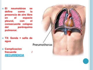  El neumotórax se
define como la
presencia de aire libre
en el espacio
pleural, con el
consecuente colapso
del parénquima
pulmonar.
 TX: Sonda + sello de
agua
 Complicacion
frecuente /
RECURRENCIA
 