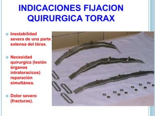INDICACIONES FIJACION
QUIRURGICA TORAX
 Inestabilidad
severa de una parte
extensa del tórax.
 Necesidad
quirurgica (lesión
órganos
intratoracicos)
reparación
simultánea.
 Dolor severo
(fracturas).
 