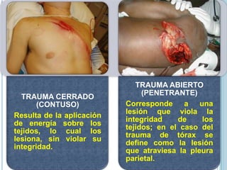 TRAUMA CERRADO
(CONTUSO)
Resulta de la aplicación
de energía sobre los
tejidos, lo cual los
lesiona, sin violar su
integridad.
TRAUMA ABIERTO
(PENETRANTE)
Corresponde a una
lesión que viola la
integridad de los
tejidos; en el caso del
trauma de tórax se
define como la lesión
que atraviesa la pleura
parietal.
 