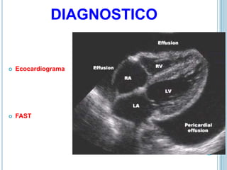 DIAGNOSTICO
 Ecocardiograma
 FAST
 
