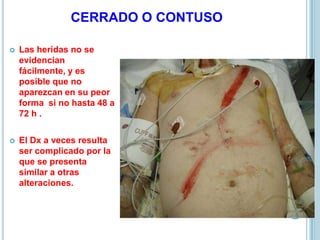 CERRADO O CONTUSO
 Las heridas no se
evidencian
fácilmente, y es
posible que no
aparezcan en su peor
forma si no hasta 48 a
72 h .
 El Dx a veces resulta
ser complicado por la
que se presenta
similar a otras
alteraciones.
 
