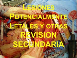 LESIONES
POTENCIALMENTE
LETALES Y OTRAS
REVISION
SECUNDARIA
 
