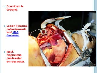  Ocurrir sin fx
costales.
 Lesión Torácica /
potencialmente
letal MAS
frecuente.
 Insuf.
respiratoria
puede estar
enmascarada.
 