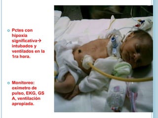  Pctes con
hipoxia
significativa
intubados y
ventilados en la
1ra hora.
 Monitoreo:
oxímetro de
pulso, EKG, GS
A, ventilación
apropiada.
 
