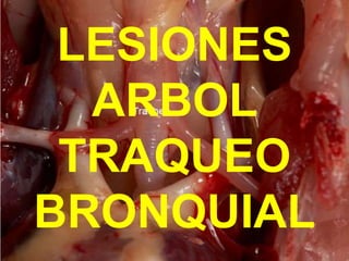 LESIONES
ARBOL
TRAQUEO
BRONQUIAL
 