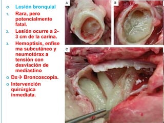  Lesión bronquial
1. Rara, pero
potencialmente
fatal.
2. Lesión ocurre a 2-
3 cm de la carina.
3. Hemoptisis, enfise
ma subcutáneo y
neumotórax a
tensión con
desviación de
mediastino
 Dx Broncoscopia.
 Intervención
quirúrgica
inmediata.
 