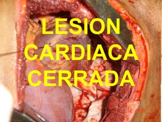 LESION
CARDIACA
CERRADA
 