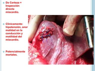  Dx Certeza =
Inspección
directa
miocardio.
 Clínicamente:
hipotensión, anor
malidad en la
conducción y
motilidad del
miocardio.
 Potencialmente
mortales.
 