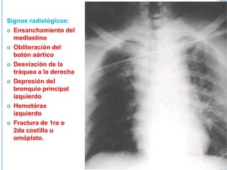 Signos radiológicos:
 Ensanchamiento del
mediastino
 Obliteración del
botón aórtico
 Desviación de la
tráquea a la derecha
 Depresión del
bronquio principal
izquierdo
 Hemotórax
izquierdo
 Fractura de 1ra o
2da costilla u
omóplato.
 