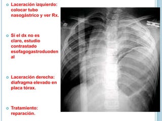  Laceración izquierdo:
colocar tubo
nasogástrico y ver Rx.
 Si el dx no es
claro, estudio
contrastado
esofagogastroduoden
al
 Laceración derecha:
diafragma elevado en
placa tórax.
 Tratamiento:
reparación.
 