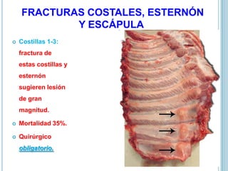 FRACTURAS COSTALES, ESTERNÓN
Y ESCÁPULA
 Costillas 1-3:
fractura de
estas costillas y
esternón
sugieren lesión
de gran
magnitud.
 Mortalidad 35%.
 Quirúrgico
obligatorio.
 