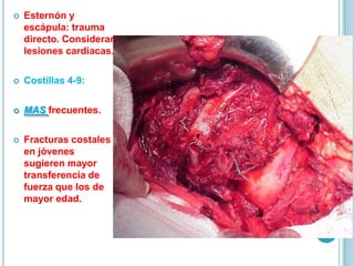  Esternón y
escápula: trauma
directo. Considerar
lesiones cardiacas.
 Costillas 4-9:
 MAS frecuentes.
 Fracturas costales
en jóvenes
sugieren mayor
transferencia de
fuerza que los de
mayor edad.
 