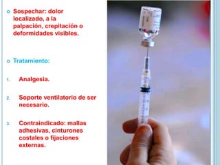  Sospechar: dolor
localizado, a la
palpación, crepitación o
deformidades visibles.
 Tratamiento:
1. Analgesia.
2. Soporte ventilatorio de ser
necesario.
3. Contraindicado: mallas
adhesivas, cinturones
costales o fijaciones
externas.
 