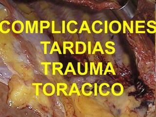 COMPLICACIONES
TARDIAS
TRAUMA
TORACICO
 