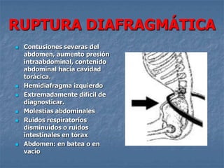 RUPTURA DIAFRAGMÁTICA
   Contusiones severas del
    abdomen, aumento presión
    intraabdominal, contenido
    abdominal hacia cavidad
    torácica.
   Hemidiafragma izquierdo
   Extremadamente difícil de
    diagnosticar.
   Molestias abdominales
   Ruidos respiratorios
    disminuídos o ruidos
    intestinales en tórax
   Abdomen: en batea o en
    vacío
 