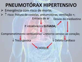 PNEUMOTÓRAX HIPERTENSIVO
 Emergência com risco de morte;
  risco: fratura de costelas, pneumotórax, ventilação +;
Entrada de ar
P
. intratorácica ELEVADA;
Comprometimento ventilatório/ retorno venoso ao coração;
 Troca gasosa  Débito cardíaco
CHOQUE
Desvio do mediastino
 