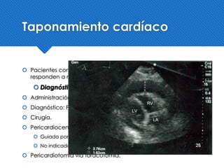Trauma torácicoo | PPTX