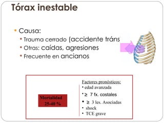Tórax inestable Causa: Trauma cerrado  (accidente tránsito) Otras:  caídas, agresiones Frecuente en  ancianos Mortalidad  25-40 % Factores pronósticos: edad avanzada    7 fx. costales   3 les. Asociadas shock TCE grave 