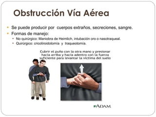 Obstrucción Vía Aérea Se puede producir por  cuerpos extraños, secreciones, sangre.  Formas de manejo: No quirúrgico: Maniobra de Heimlich, intubación oro o nasotraqueal. Quirúrgico: cricotiroidotomía  y  traqueotomía. 