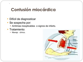 .        Contusión miocárdica Difícil de diagnosticar Se sospecha por: Arritmias inexplicables  o signos de infarto. Tratamiento: Manejo  clínico. 