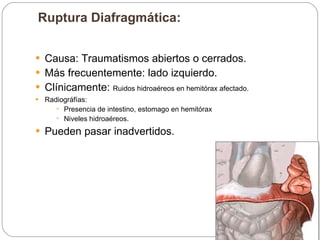 Ruptura Diafragmática:  Causa: Traumatismos abiertos o cerrados. Más frecuentemente: lado izquierdo. Clínicamente:  Ruidos hidroaéreos en hemitórax afectado. Radiográfías:  Presencia de intestino, estomago en hemitórax Niveles hidroaéreos. Pueden pasar inadvertidos.  