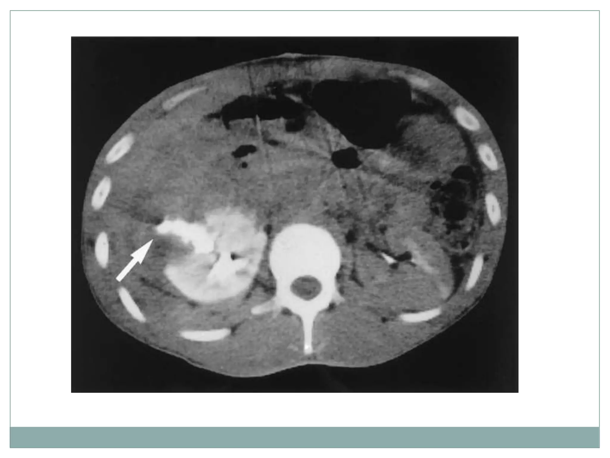 Trauma to the genitourinary tract. | PPTX