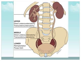 Trauma to the genitourinary tract. | PPTX