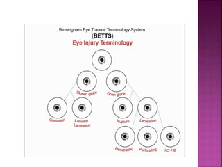 Betts Classification TRAUMA TO THE GLOBE-ocular trauma-1.pptx