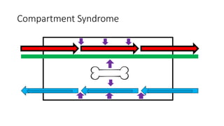 Compartment Syndrome
 