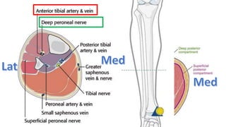 Compartments in the Lower Leg
 