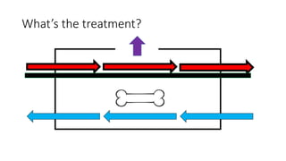 What’s the treatment?
 