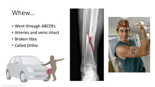 Whew…
• Went through ABCDEs
• Arteries and veins intact
• Broken tibia
• Called Ortho
 