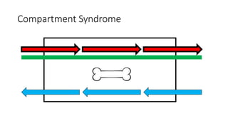 Compartment Syndrome
 