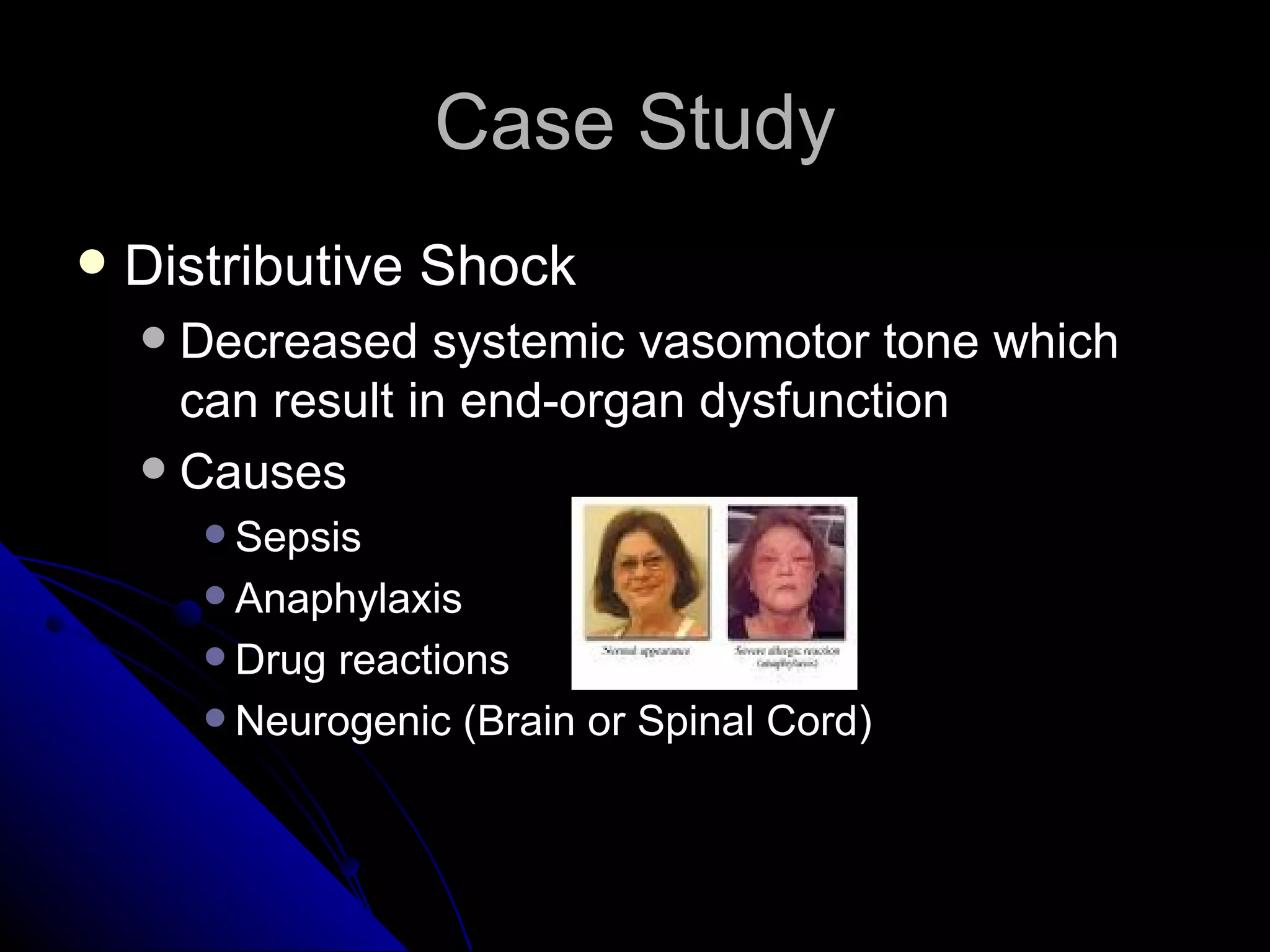 Case Study
   Distributive Shock
     Decreased systemic vasomotor tone which
      can result in end-organ dysfunction
     Causes
         Sepsis
         Anaphylaxis
         Drug reactions
         Neurogenic (Brain or Spinal Cord)
 