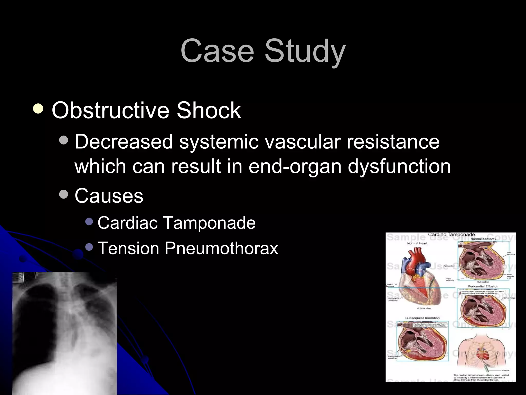Case Study
   Obstructive Shock
     Decreased systemic vascular resistance
      which can result in end-organ dysfunction
     Causes
         Cardiac Tamponade
         Tension Pneumothorax
 
