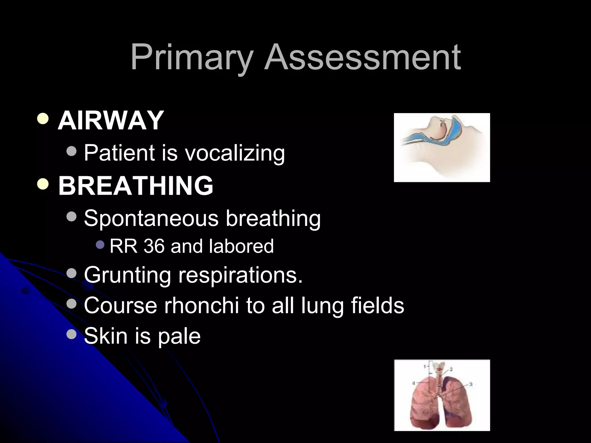 Primary Assessment
   AIRWAY
       Patient is vocalizing
   BREATHING
       Spontaneous breathing
          RR   36 and labored
     Grunting respirations.
     Course rhonchi to all lung fields
     Skin is pale
 