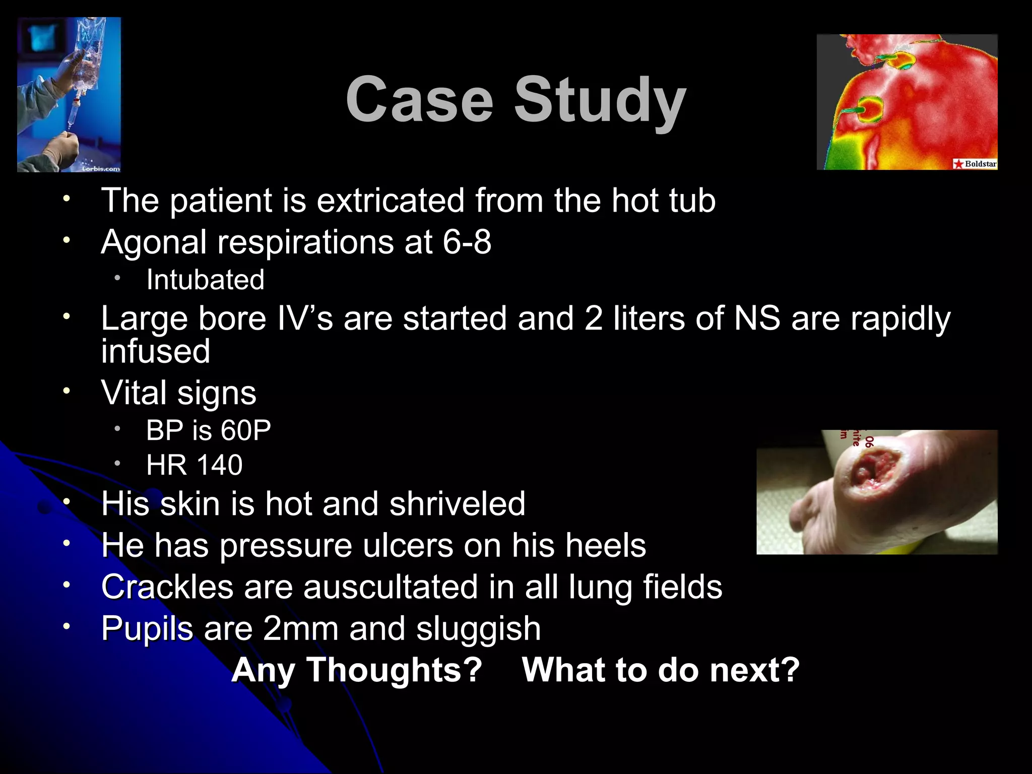 Case Study
•   The patient is extricated from the hot tub
•   Agonal respirations at 6-8
    •   Intubated
•   Large bore IV’s are started and 2 liters of NS are rapidly
    infused
•   Vital signs
    •   BP is 60P
    •   HR 140
•   His skin is hot and shriveled
•   He has pressure ulcers on his heels
•   Crackles are auscultated in all lung fields
•   Pupils are 2mm and sluggish
             Any Thoughts? What to do next?
 
